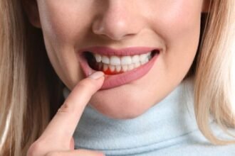 woman pulling lip showing gums